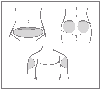 Пластир потрібно приклеювати на такі ділянки тіла (див. зображення нижче): живіт, сідниці, зовнішня верхня частина плеча