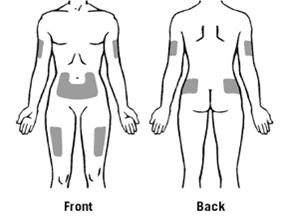 Переважні ділянки тіла для підшкірного введення Зарсіо® показані на рисунку