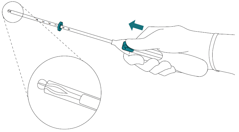 Штовхати повзун вперед у напрямку стрілки у найдальше положення для зарядження системи Мірена у трубку для введення 