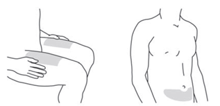 Якщо ін’єкцію проводить ваш помічник, можна також використати зовнішню поверхню верхньої частини плеча.
